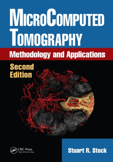 MicroComputed Tomography : Methodology and Applications, Second Edition, PDF eBook
