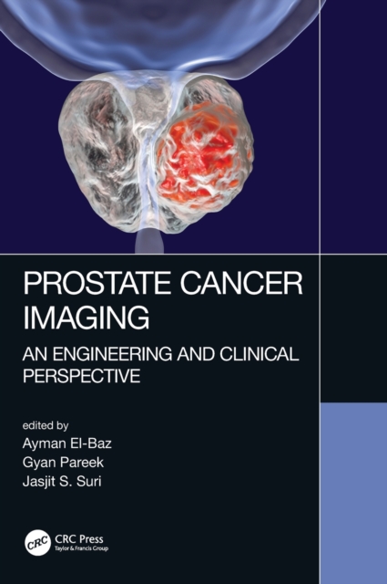 Prostate Cancer Imaging : An Engineering and Clinical Perspective, Hardback Book