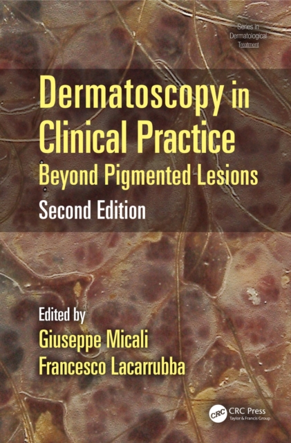 Dermatoscopy in Clinical Practice : Beyond Pigmented Lesions, EPUB eBook