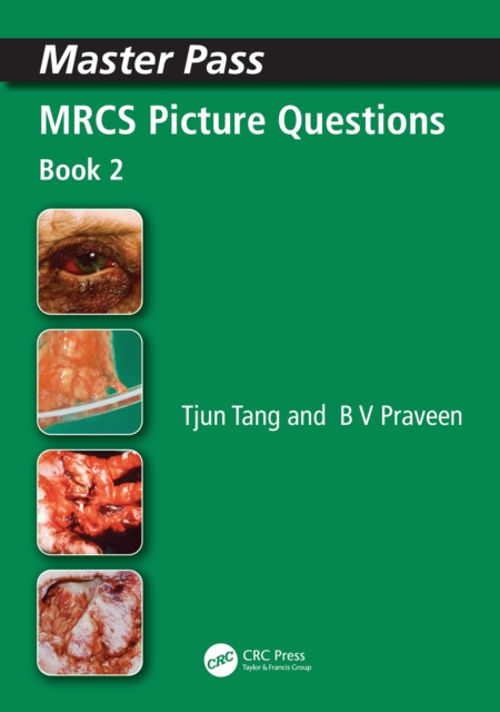 MRCS Picture Questions : A Practical Guide, v. 3, PDF eBook