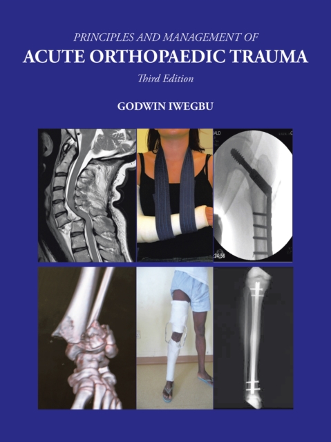 Principles and Management of Acute Orthopaedic Trauma : Third Edition, EPUB eBook
