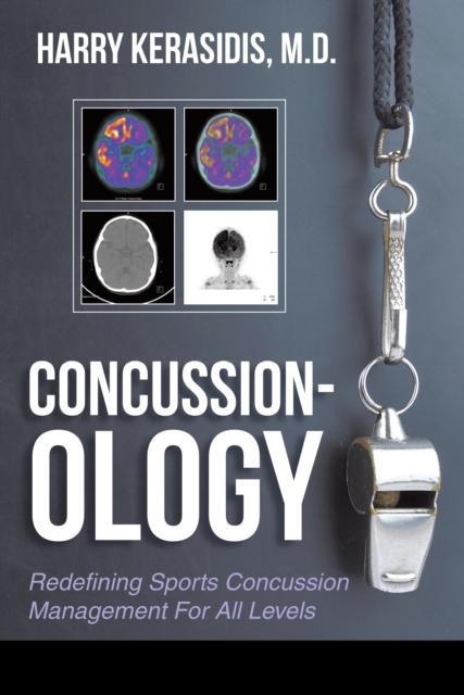 Concussion-Ology : Redefining Sports Concussion Management for All Levels, EPUB eBook