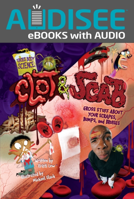 Clot & Scab : Gross Stuff about Your Scrapes, Bumps, and Bruises, EPUB eBook
