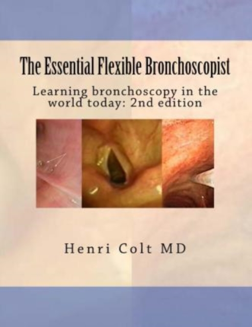 The Essential Flexible Bronchoscopist : Learning bronchoscopy in the world today, Paperback / softback Book