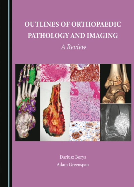 None Outlines of Orthopaedic Pathology and Imaging : A Review, PDF eBook