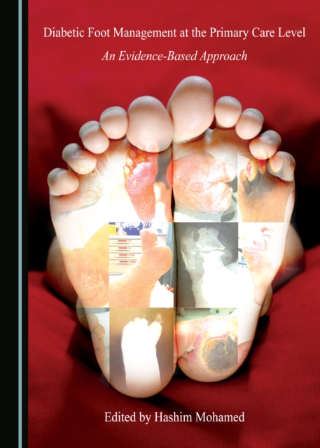 None Diabetic Foot Management at the Primary Care Level : An Evidence-Based Approach, PDF eBook