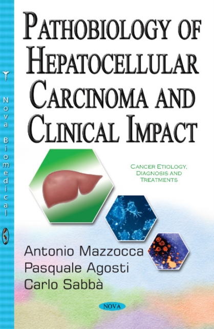 Pathobiology of Hepatocellular Carcinoma & Clinical Impact, Paperback / softback Book
