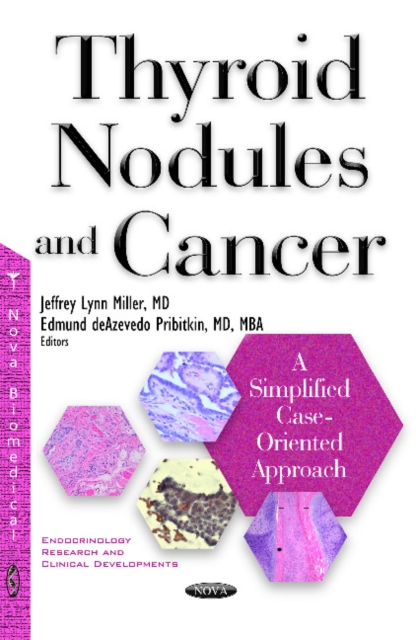 Thyroid Nodules & Cancer : A Simplified Case Oriented Approach, Paperback / softback Book