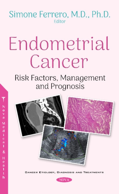 Endometrial Cancer : Risk Factors, Management and Prognosis, Hardback Book