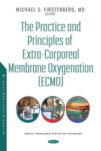 The Practice and Principles of Extra-Corporeal Membrane Oxygenation (ECMO), Hardback Book