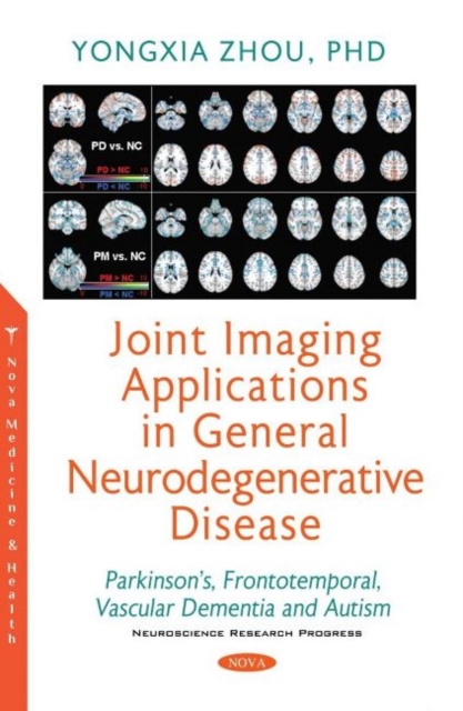 Joint Imaging Applications in General Neurodegenerative Disease : Parkinson's, Frontotemporal, Vascular Dementia and Autism, Paperback / softback Book