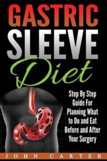 Gastric Sleeve Diet : Step By Step Guide For Planning What to Do and Eat Before and After Your Surgery, Paperback / softback Book