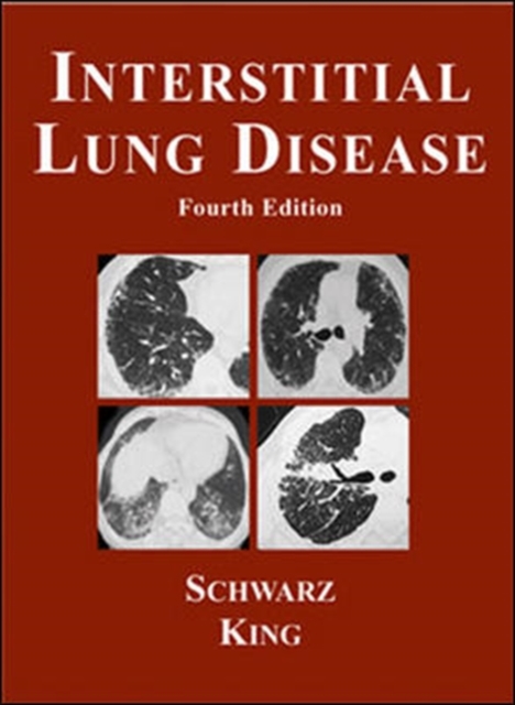 Interstitial Lung Disease, Mixed media product Book