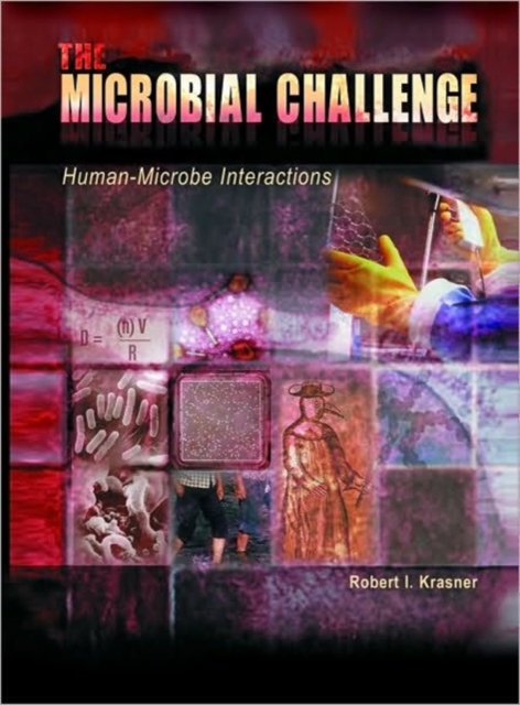 Microbial Challenge: Human-microbe Interactions, Paperback Book