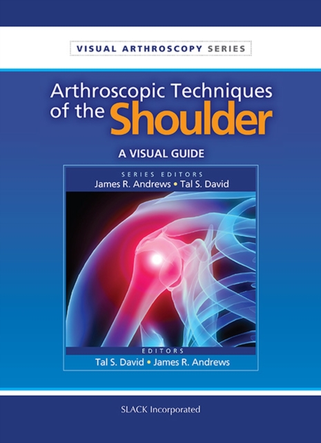 Arthroscopic Techniques of the Shoulder : A Visual Guide, Paperback / softback Book