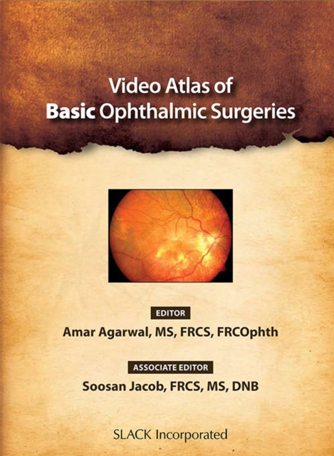 Video Atlas of Basic Ophthalmic Surgeries, DVD video Book