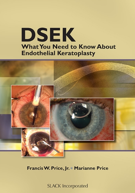 DSEK : What You Need to Know About Endothelial Keratoplasty, Hardback Book