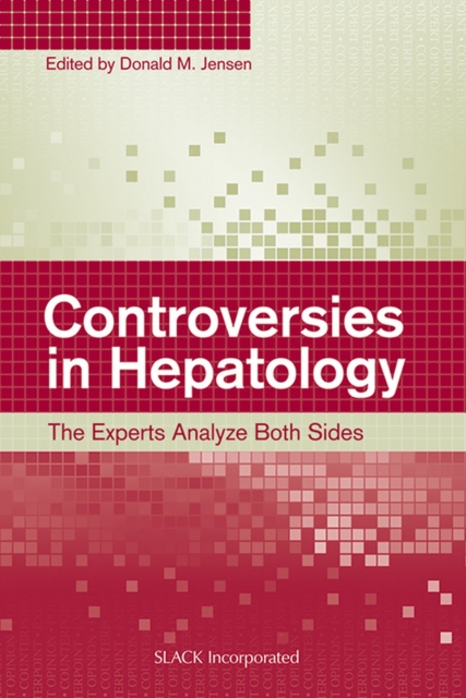 Controversies in Hepatology : The Experts Analyze Both Sides, Paperback / softback Book