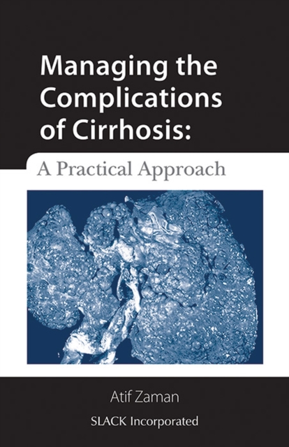 Managing the Complications of Cirrhosis : A Practical Approach, Paperback / softback Book