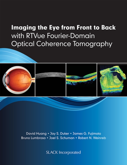 Imaging the Eye from Front to Back, Hardback Book