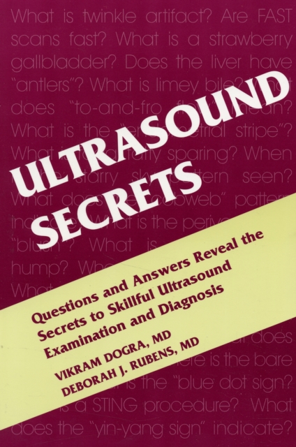 Ultrasound Secrets, Paperback / softback Book