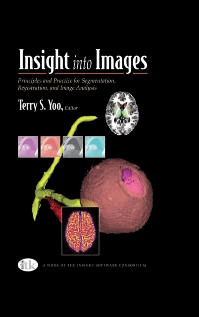 Insight into Images : Principles and Practice for Segmentation, Registration, and Image Analysis, Hardback Book
