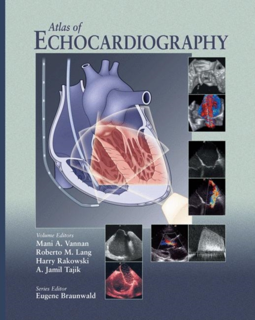 Atlas of Echocardiography, Hardback Book