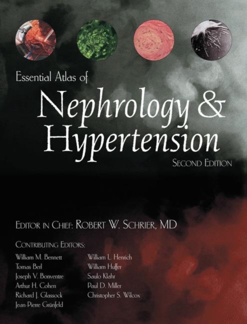 Essential Atlas of Nephrology & Hypertension, Hardback Book