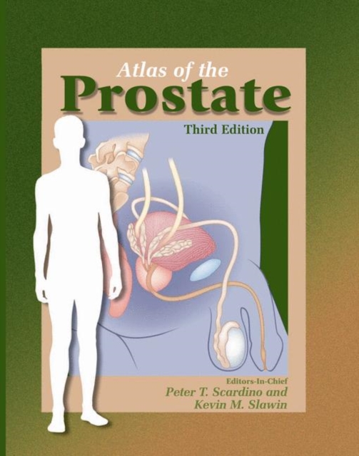 Atlas of the Prostate, Hardback Book