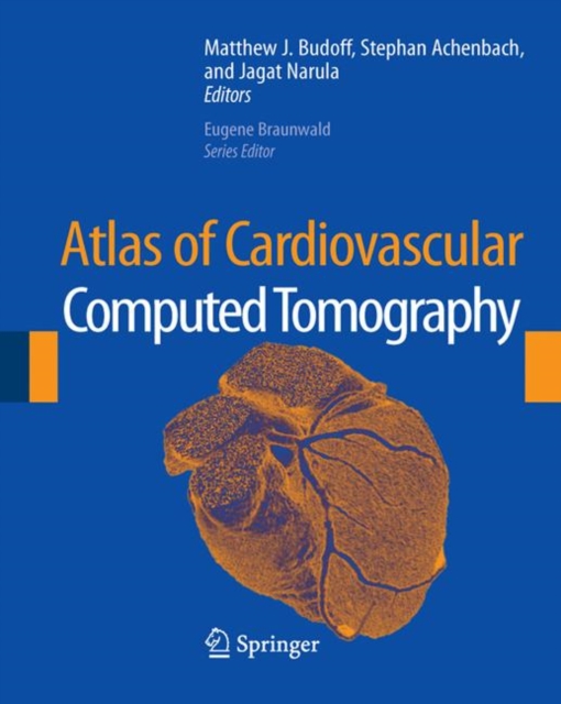 Atlas of Cardiovascular Computed Tomography, Hardback Book