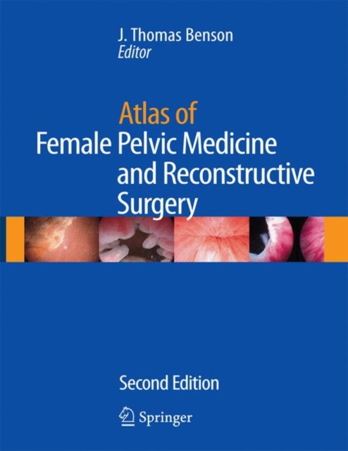 Atlas of Female Pelvic Medicine and Reconstructive Surgery, Mixed media product Book