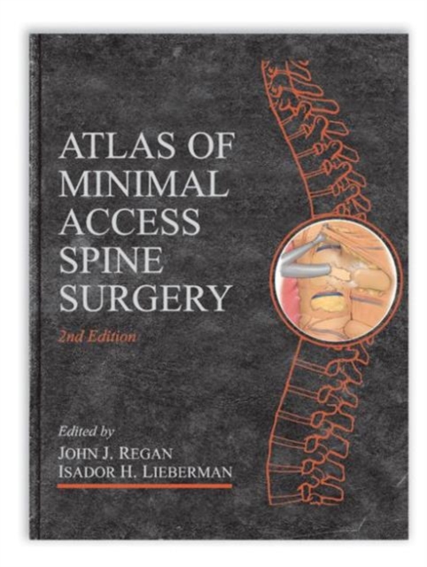 Atlas of Minimal Access Spine Surgery, Mixed media product Book