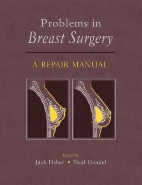 Problems in Breast Surgery : A Repair Manual, Mixed media product Book