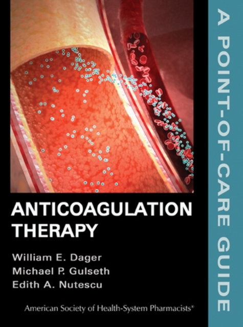 Anticoagulation Therapy, Paperback / softback Book