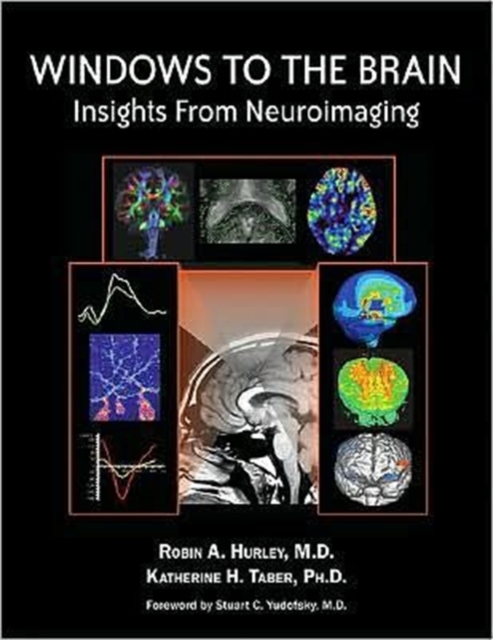 Windows to the Brain : Insights From Neuroimaging, Hardback Book