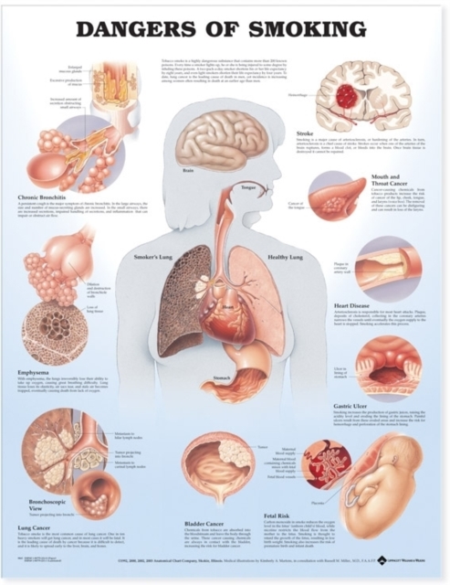 Dangers of Smoking Anatomical Chart, Wallchart Book