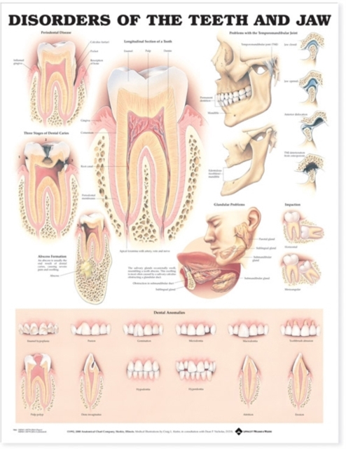 Disorders of the Teeth and Jaw Anatomical Chart, Wallchart Book
