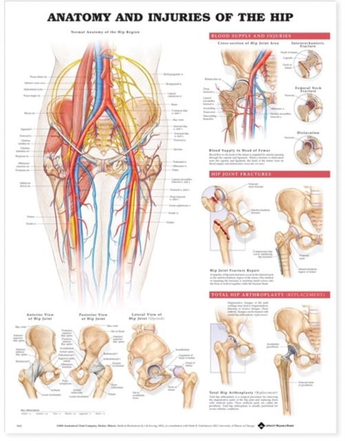 Anatomy and Injuries of the Hip Anatomical Chart, Wallchart Book