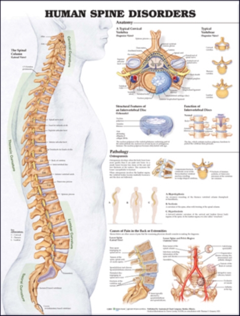 Human Spine Disorders Anatomical Chart, Wallchart Book