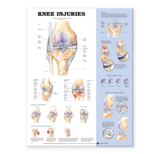 Knee Injuries Anatomical Chart, Wallchart Book