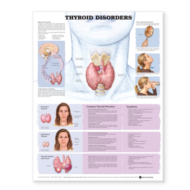Thyroid Disorders Anatomical Chart, Wallchart Book
