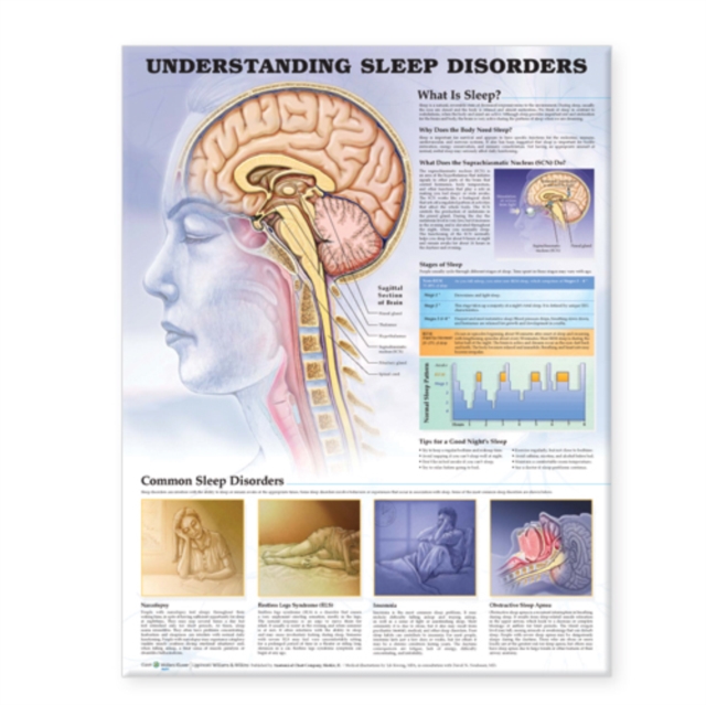 Understanding Sleep Disorders Anatomical Chart, Wallchart Book