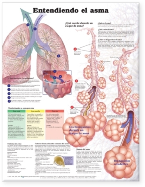 Understanding Asthma Anatomical Chart in Spanish (Entendiendo El Asma), Wallchart Book
