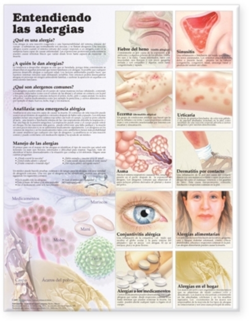 Understanding Allergies Anatomical Chart in Spanish (Entendiendo Las Alergias), Wallchart Book