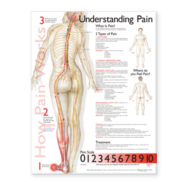 Understanding Pain Anatomical Chart, Wallchart Book