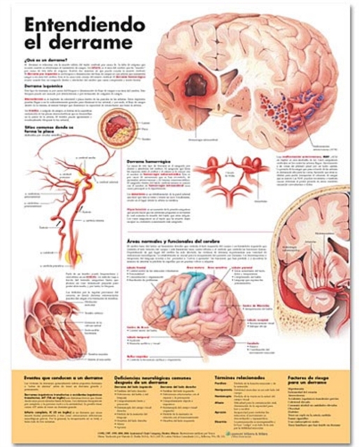 Understanding Stroke Anatomical Chart in Spanish (Entendiendo que es un derrame), Wallchart Book