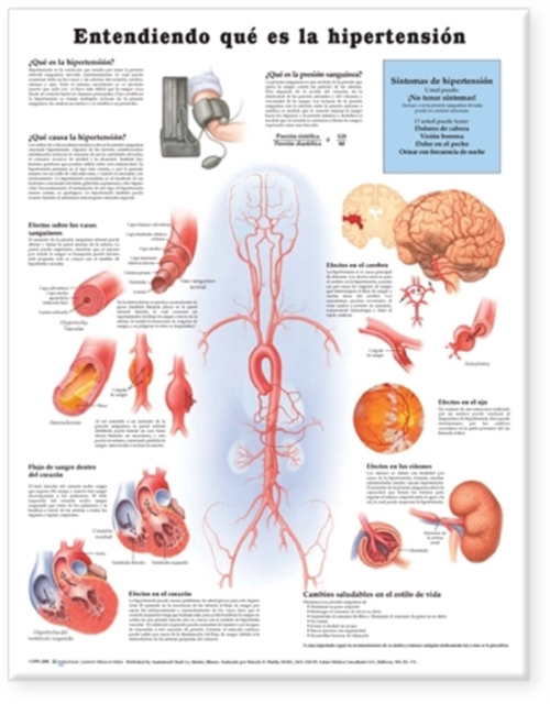 Understanding Hypertension Anatomical Chart in Spanish (Entendiendo Que Es la Hypertension), Wallchart Book