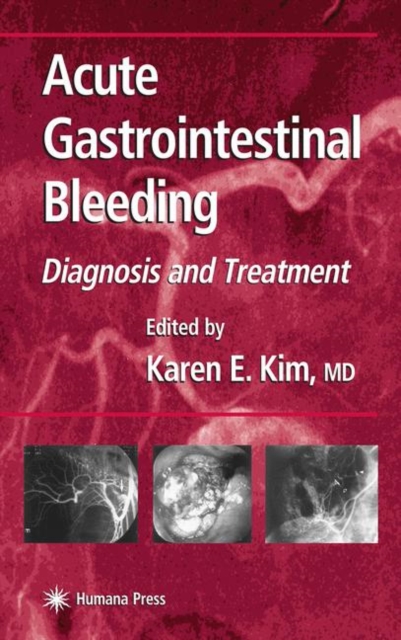 Acute Gastrointestinal Bleeding : Diagnosis and Treatment, Hardback Book