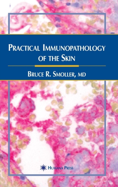 Practical Immunopathology of the Skin, Hardback Book