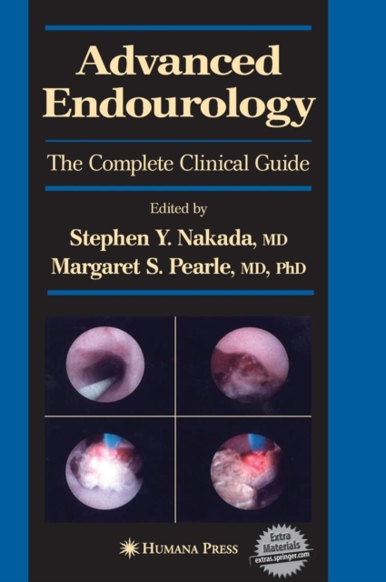 Advanced Endourology : The Complete Clinical Guide, Hardback Book